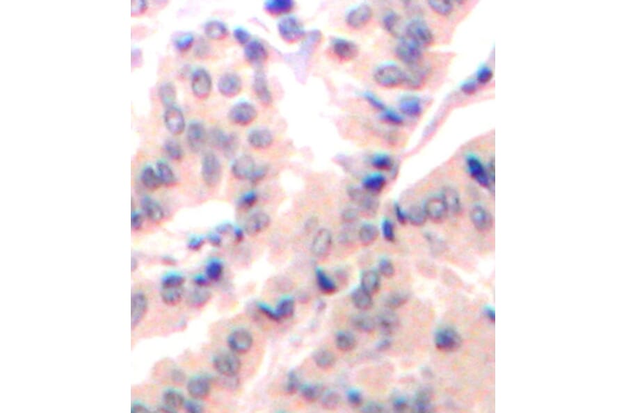 Immunohistochemistry - Anti-EIF4B (phospho S422) Antibody (AP0278) - Antibodies.com