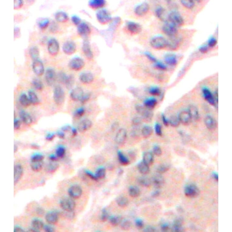 Immunohistochemistry - Anti-EIF4B (phospho S422) Antibody (AP0278) - Antibodies.com