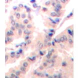 Immunohistochemistry - Anti-EIF4B (phospho S422) Antibody (AP0278) - Antibodies.com