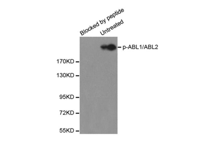 Western Blot - Anti-ABL1 (phosphoY393) + ABL2 (phosphoY429) Antibody (AP0282) - Antibodies.com