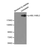 Western Blot - Anti-ABL1 (phosphoY393) + ABL2 (phosphoY429) Antibody (AP0282) - Antibodies.com