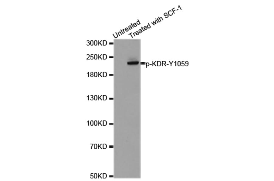 Western Blot - Anti-KDR (phospho Y1059) Antibody (AP0283) - Antibodies.com