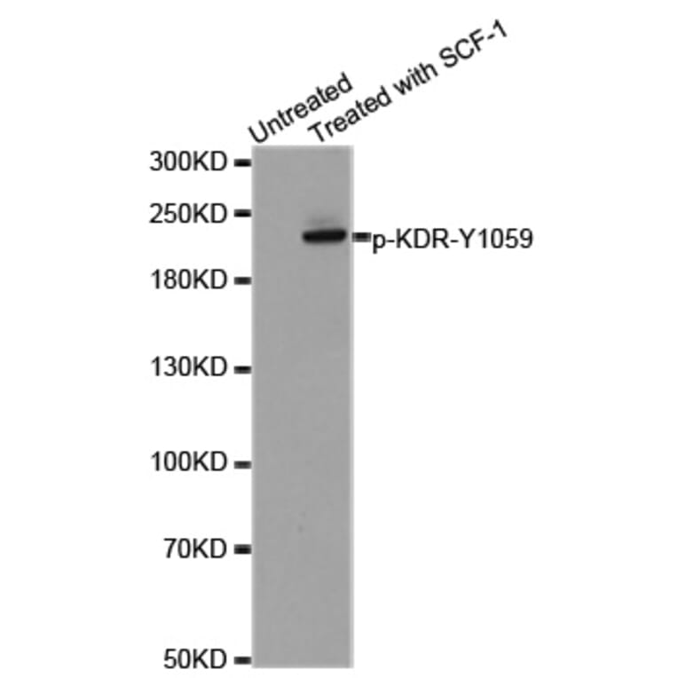 Western Blot - Anti-KDR (phospho Y1059) Antibody (AP0283) - Antibodies.com