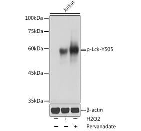 Western Blot - Anti-Lck (phospho Tyr505) Antibody (A12479) - Antibodies.com