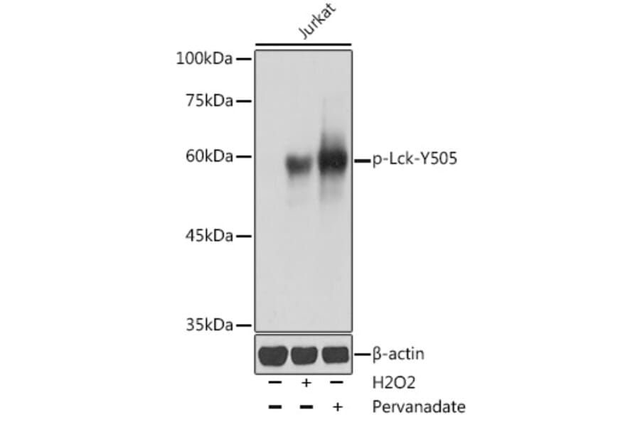 Western Blot - Anti-Lck (phospho Tyr505) Antibody (A12479) - Antibodies.com