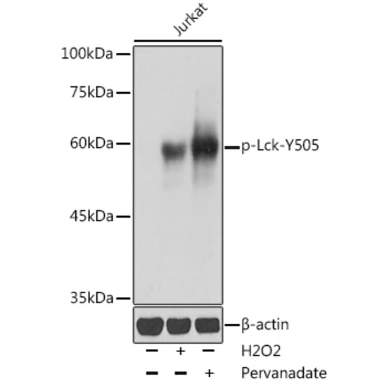 Western Blot - Anti-Lck (phospho Tyr505) Antibody (A12479) - Antibodies.com