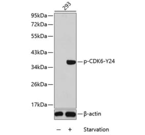 Western Blot - Anti-Cdk6 (phospho Tyr24) Antibody (A12480) - Antibodies.com