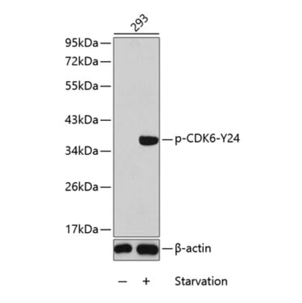 Western Blot - Anti-Cdk6 (phospho Tyr24) Antibody (A12480) - Antibodies.com