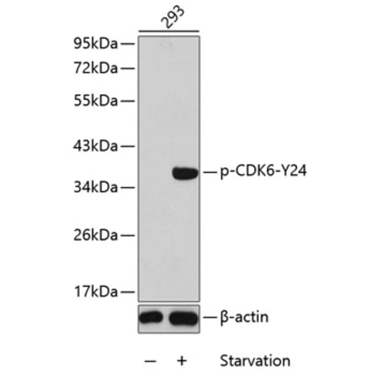 Western Blot - Anti-Cdk6 (phospho Tyr24) Antibody (A12480) - Antibodies.com