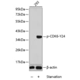 Western Blot - Anti-Cdk6 (phospho Tyr24) Antibody (A12480) - Antibodies.com