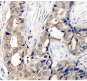 Immunohistochemistry - Anti-ABL1 (Phospho Y412) Antibody (A12481) - Antibodies.com