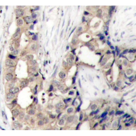 Immunohistochemistry - Anti-ABL1 (Phospho Y412) Antibody (A12481) - Antibodies.com