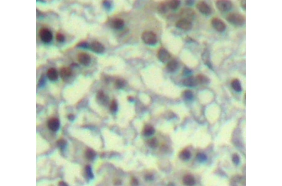Immunohistochemistry - Anti-AURKA (phospho T288) Antibody (AP0311) - Antibodies.com