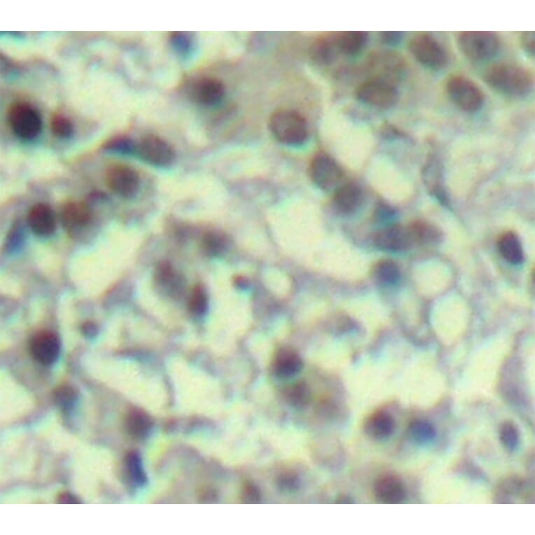 Immunohistochemistry - Anti-AURKA (phospho T288) Antibody (AP0311) - Antibodies.com
