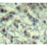 Immunohistochemistry - Anti-AURKA (phospho T288) Antibody (AP0311) - Antibodies.com
