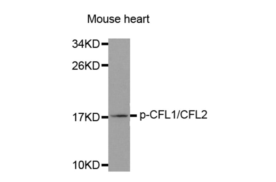 Western Blot - Anti-CFL1 (phospho Y88) + CFL2 (phospho Y88) Antibody (AP0329) - Antibodies.com