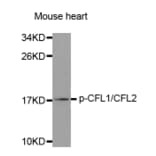 Western Blot - Anti-CFL1 (phospho Y88) + CFL2 (phospho Y88) Antibody (AP0329) - Antibodies.com