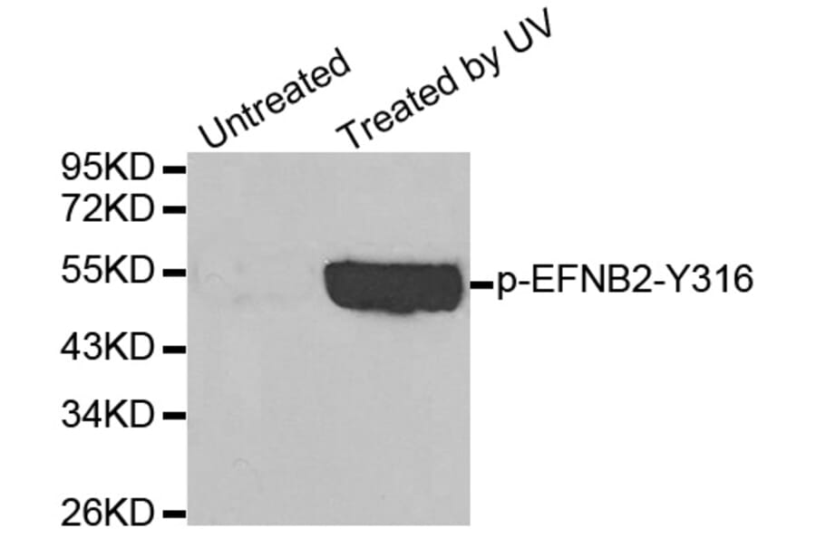 Western Blot - Anti-EFNB2 (phospho Y316) Antibody (AP0338) - Antibodies.com