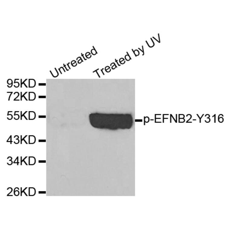 Western Blot - Anti-EFNB2 (phospho Y316) Antibody (AP0338) - Antibodies.com