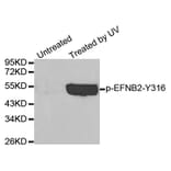 Western Blot - Anti-EFNB2 (phospho Y316) Antibody (AP0338) - Antibodies.com