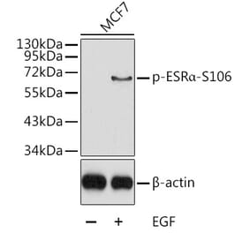 Western Blot - Anti-Estrogen Receptor alpha (phospho Ser106) Antibody (A12488) - Antibodies.com