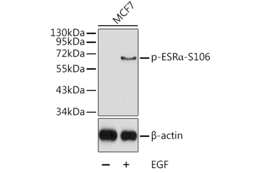 Western Blot - Anti-Estrogen Receptor alpha (phospho Ser106) Antibody (A12488) - Antibodies.com