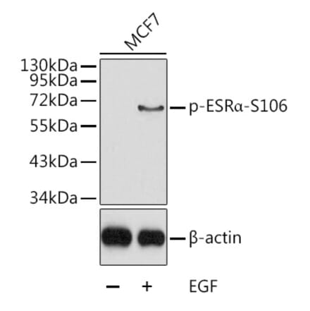 Western Blot - Anti-Estrogen Receptor alpha (phospho Ser106) Antibody (A12488) - Antibodies.com