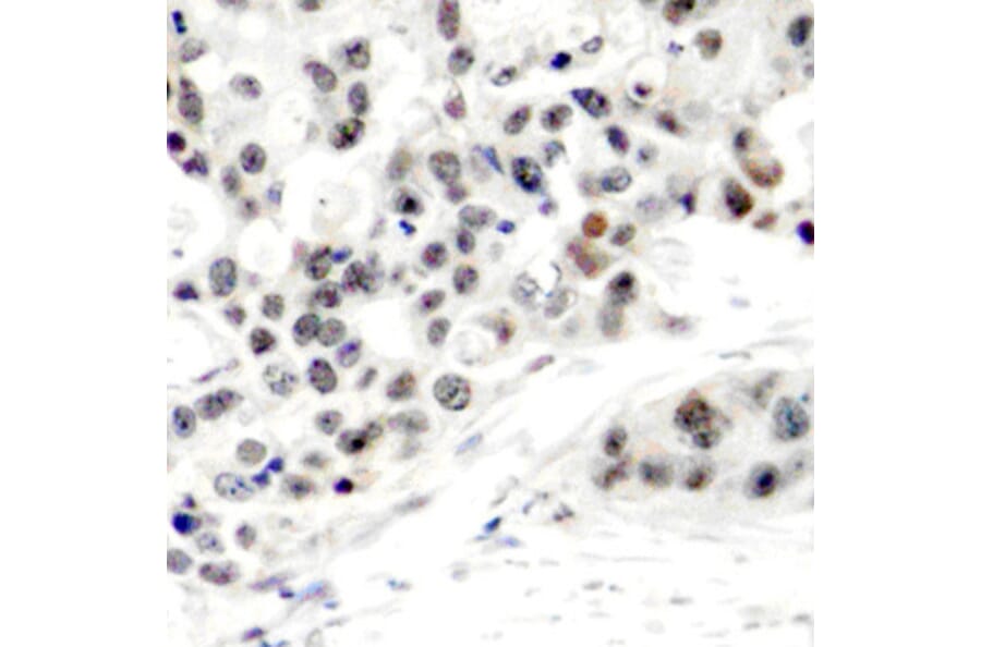 Immunohistochemistry - Anti-Estrogen Receptor alpha (phospho Ser106) Antibody (A12488) - Antibodies.com