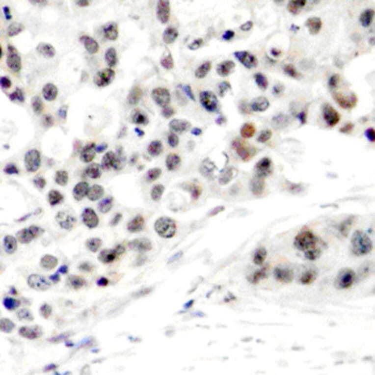 Immunohistochemistry - Anti-Estrogen Receptor alpha (phospho Ser106) Antibody (A12488) - Antibodies.com