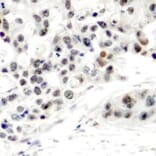 Immunohistochemistry - Anti-Estrogen Receptor alpha (phospho Ser106) Antibody (A12488) - Antibodies.com