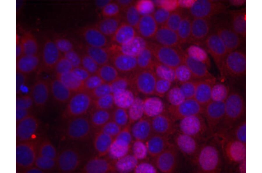 Immunofluorescence - Anti-Estrogen Receptor alpha (phospho Ser106) Antibody (A12488) - Antibodies.com