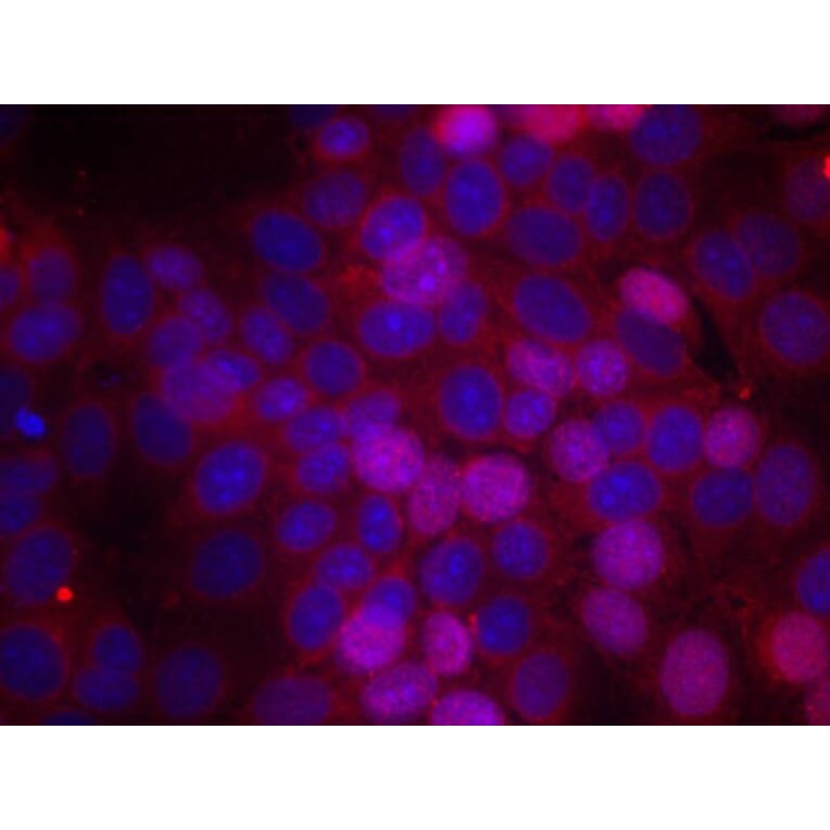 Immunofluorescence - Anti-Estrogen Receptor alpha (phospho Ser106) Antibody (A12488) - Antibodies.com
