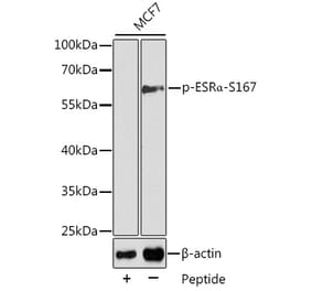 Western Blot - Anti-Estrogen Receptor alpha (phospho Ser167) Antibody (A12489) - Antibodies.com