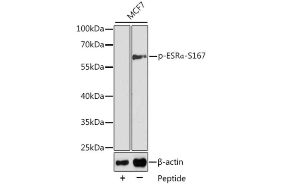 Western Blot - Anti-Estrogen Receptor alpha (phospho Ser167) Antibody (A12489) - Antibodies.com