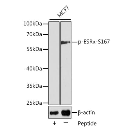 Western Blot - Anti-Estrogen Receptor alpha (phospho Ser167) Antibody (A12489) - Antibodies.com