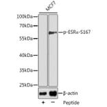 Western Blot - Anti-Estrogen Receptor alpha (phospho Ser167) Antibody (A12489) - Antibodies.com