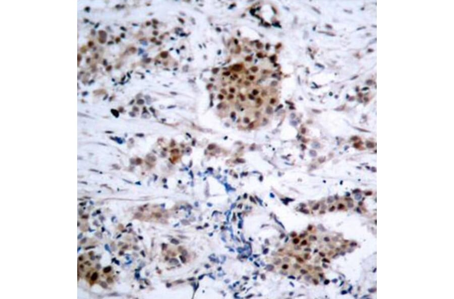 Immunohistochemistry - Anti-Estrogen Receptor alpha (phospho Ser167) Antibody (A12489) - Antibodies.com