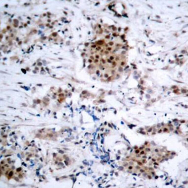 Immunohistochemistry - Anti-Estrogen Receptor alpha (phospho Ser167) Antibody (A12489) - Antibodies.com