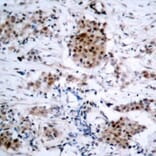 Immunohistochemistry - Anti-Estrogen Receptor alpha (phospho Ser167) Antibody (A12489) - Antibodies.com
