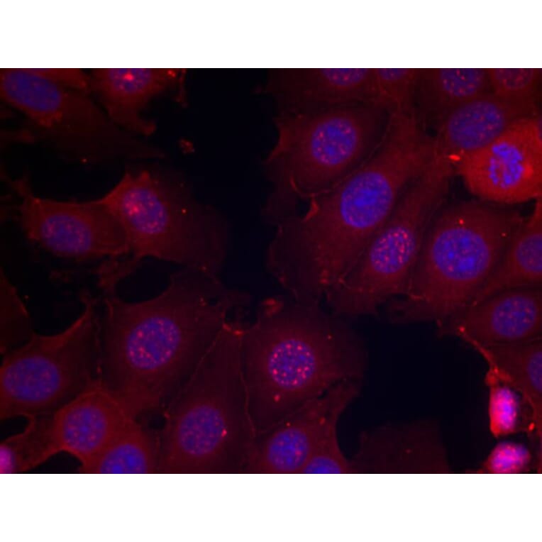 Immunofluorescence - Anti-Estrogen Receptor alpha (phospho Ser167) Antibody (A12489) - Antibodies.com