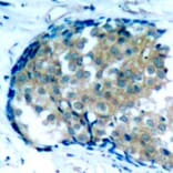 Immunohistochemistry - Anti-EZR (phospho Y353) Antibody (AP0349) - Antibodies.com