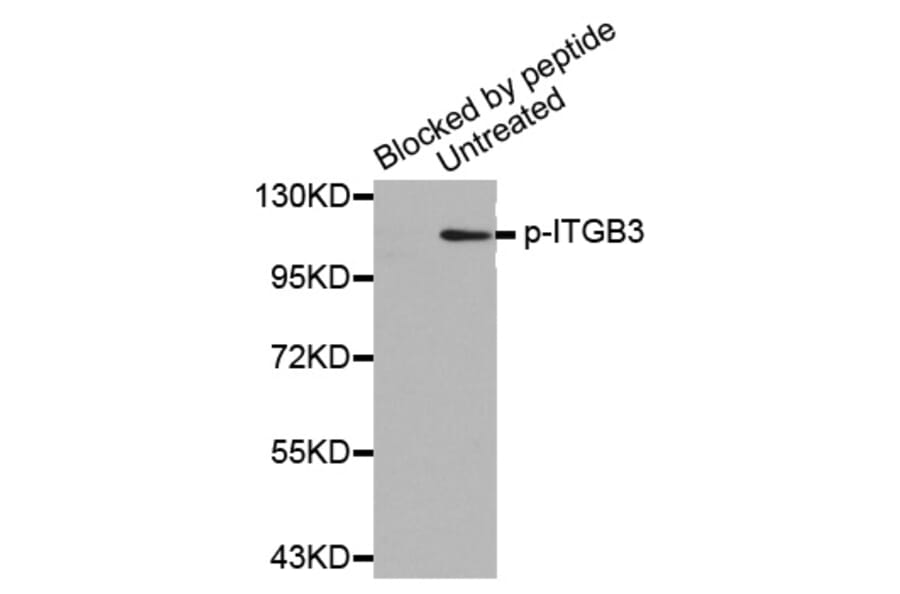 Western Blot - Anti-ITGB3 (phospho Y773) Antibody (AP0372) - Antibodies.com