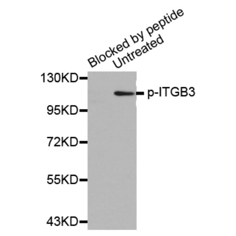 Western Blot - Anti-ITGB3 (phospho Y773) Antibody (AP0372) - Antibodies.com