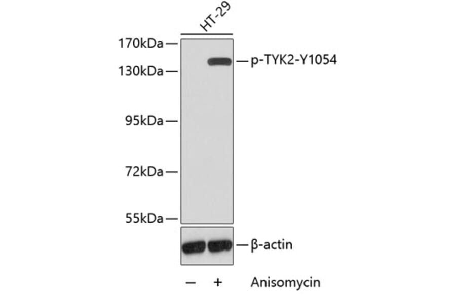 Western Blot - Anti-TYK2 (phospho Y1054) Antibody (AP0466) - Antibodies.com