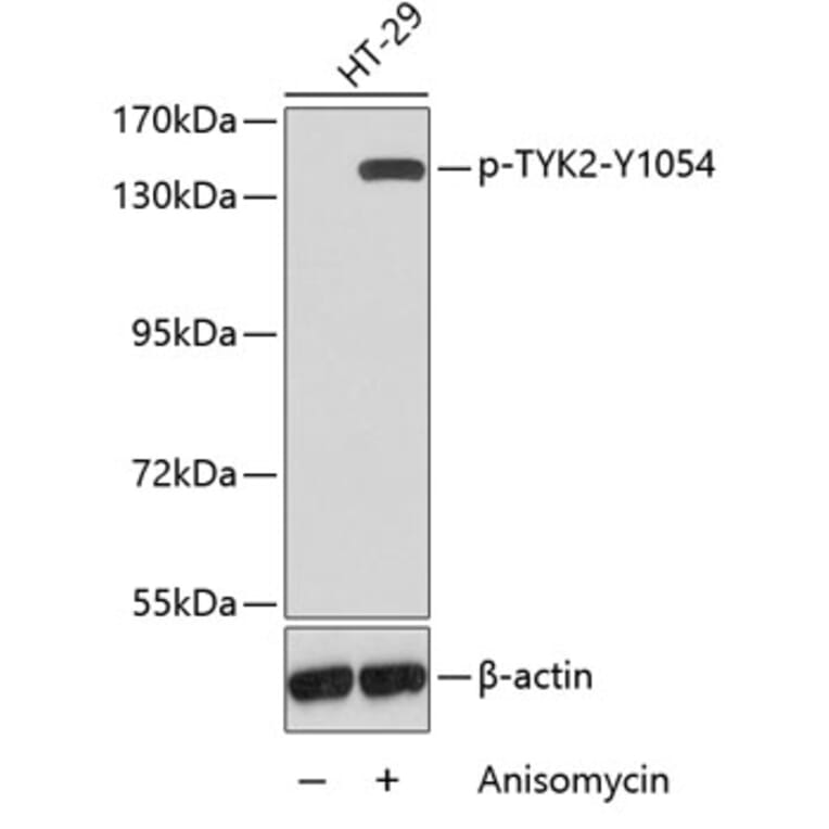 Western Blot - Anti-TYK2 (phospho Y1054) Antibody (AP0466) - Antibodies.com