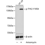 Western Blot - Anti-TYK2 (phospho Y1054) Antibody (AP0466) - Antibodies.com
