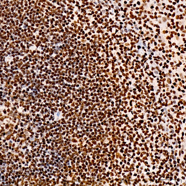 Immunohistochemistry - Anti-IRF3 (Phospho S396) Antibody (A12493) - Antibodies.com