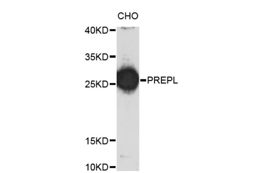 Western Blot - Anti-PREPL Antibody (A4322) - Antibodies.com