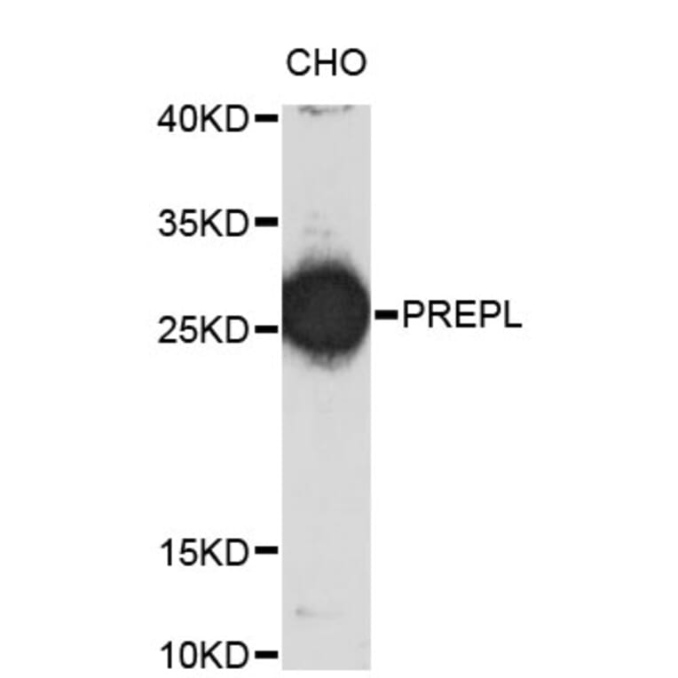 Western Blot - Anti-PREPL Antibody (A4322) - Antibodies.com