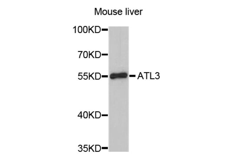 Western Blot - Anti-ATL3 Antibody (A4594) - Antibodies.com